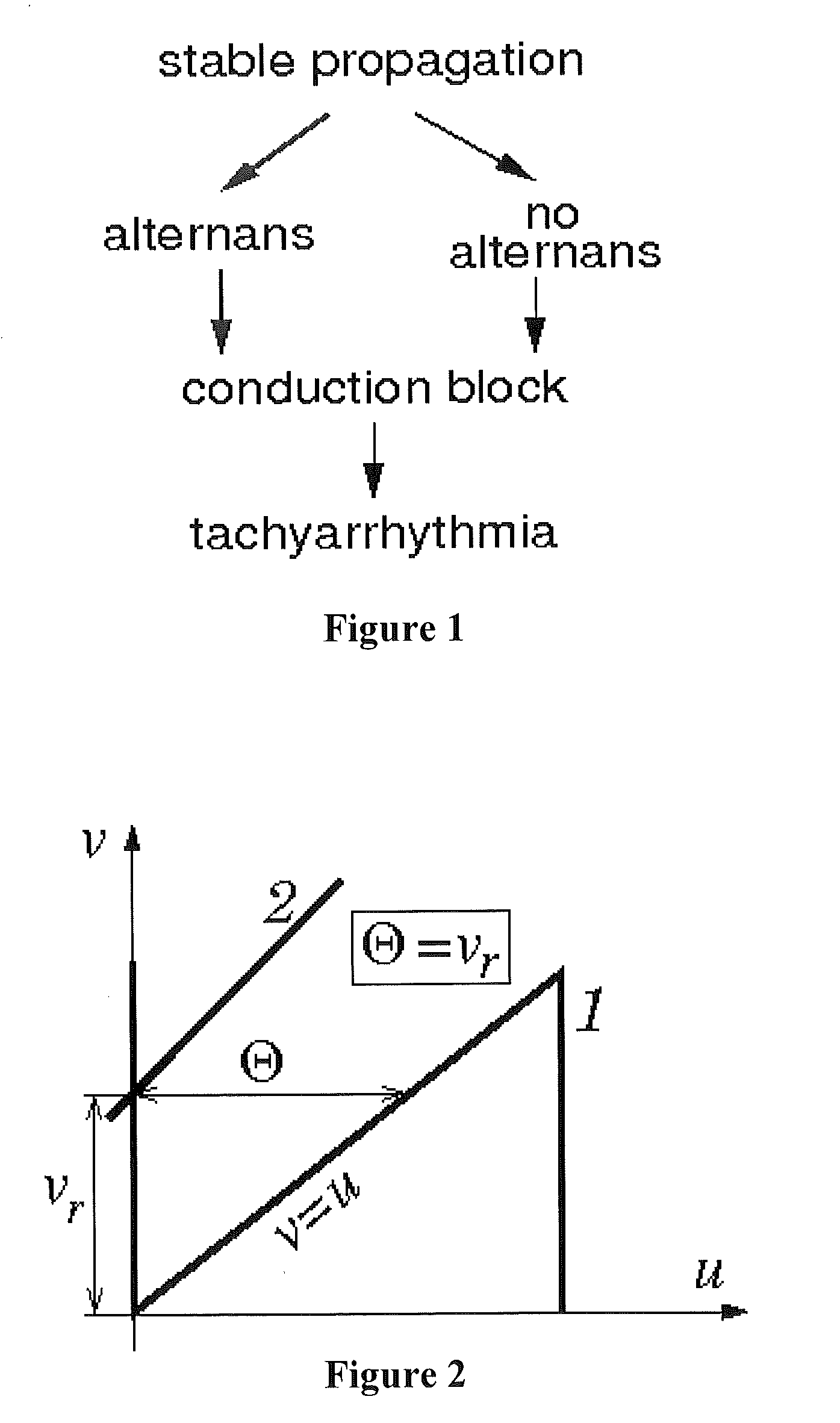 Method and system for evaluating stability of cardiac propagation reserve