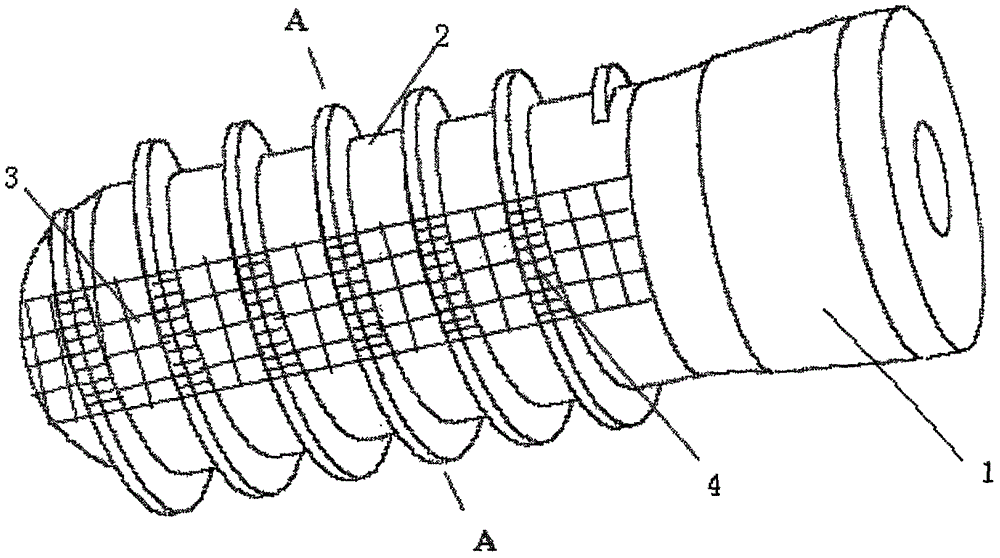 Segmented porous implant and design and manufacturing method thereof