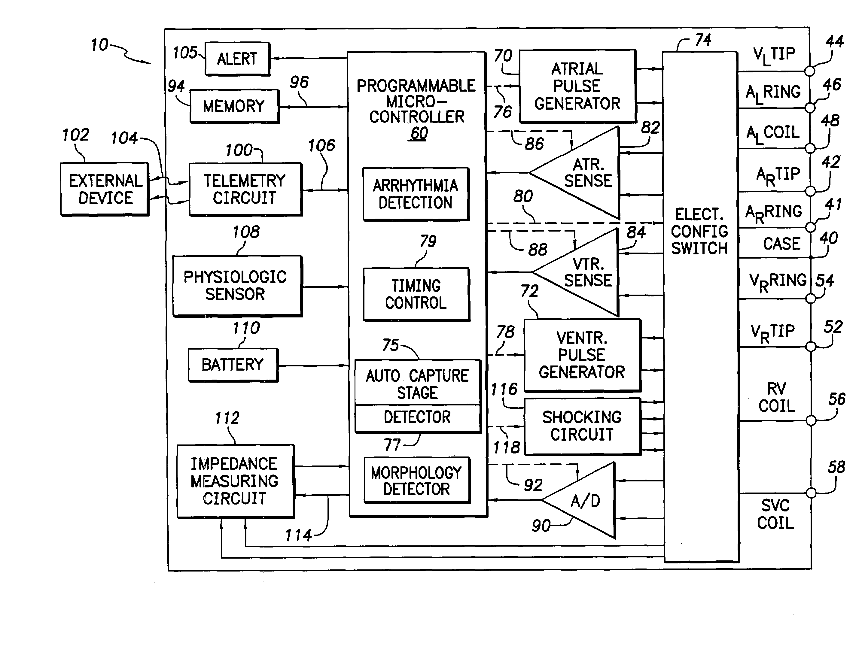 Implantable cardiac stimulation system providing autocapture and lead impedance assessment and method