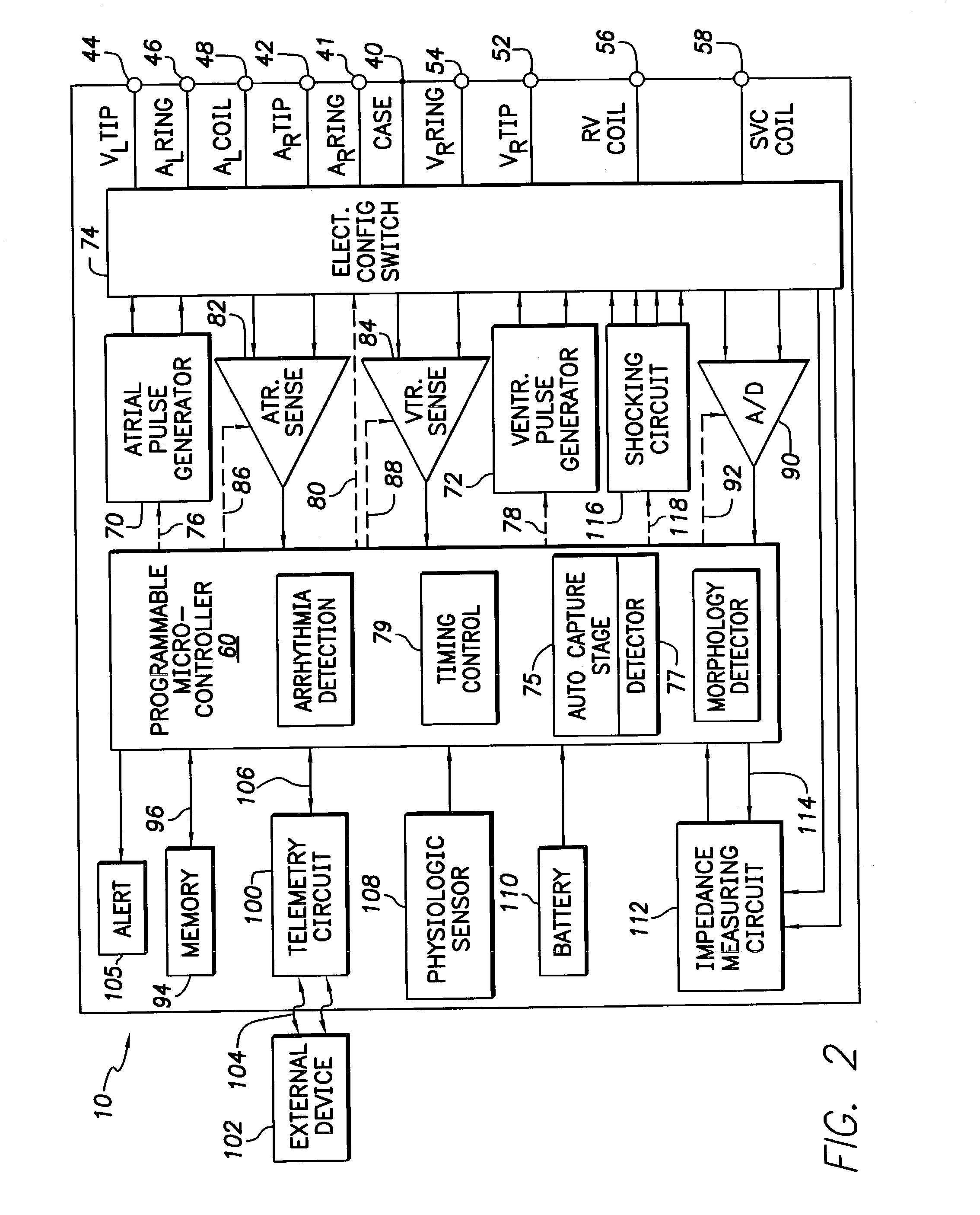 Implantable cardiac stimulation system providing autocapture and lead impedance assessment and method