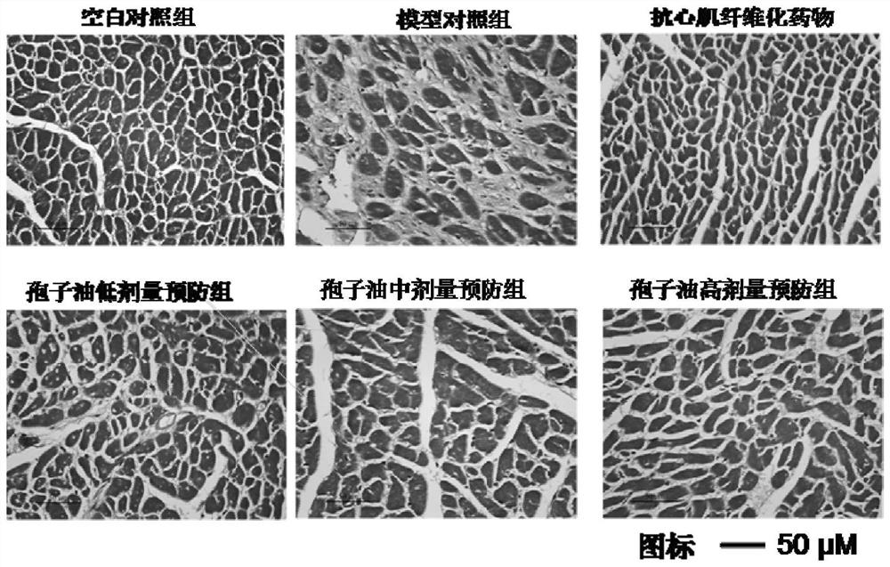 Novel application of Chizhi spore oil and/or pharmaceutical composition containing Chizhi spore oil