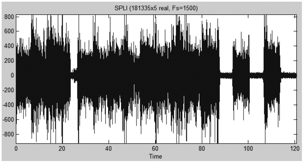 Adaptive filter for filtering power frequency interference in electromyography signal based on EEMD (Ensemble Empirical Mode Decomposition) algorithm