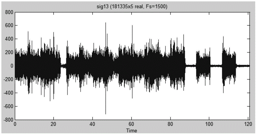 Adaptive filter for filtering power frequency interference in electromyography signal based on EEMD (Ensemble Empirical Mode Decomposition) algorithm