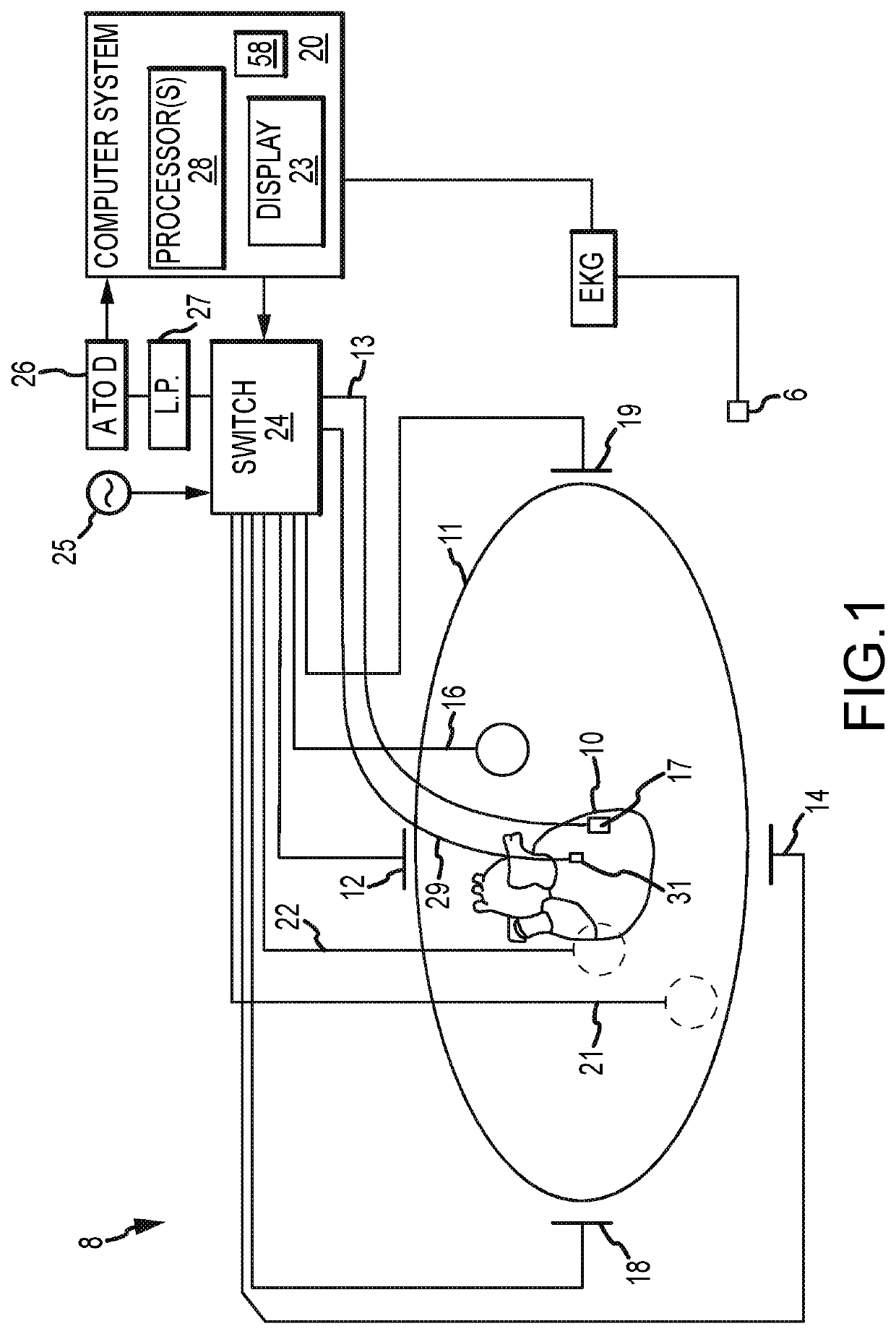 System and method for mapping cardiac muscle fiber orientation