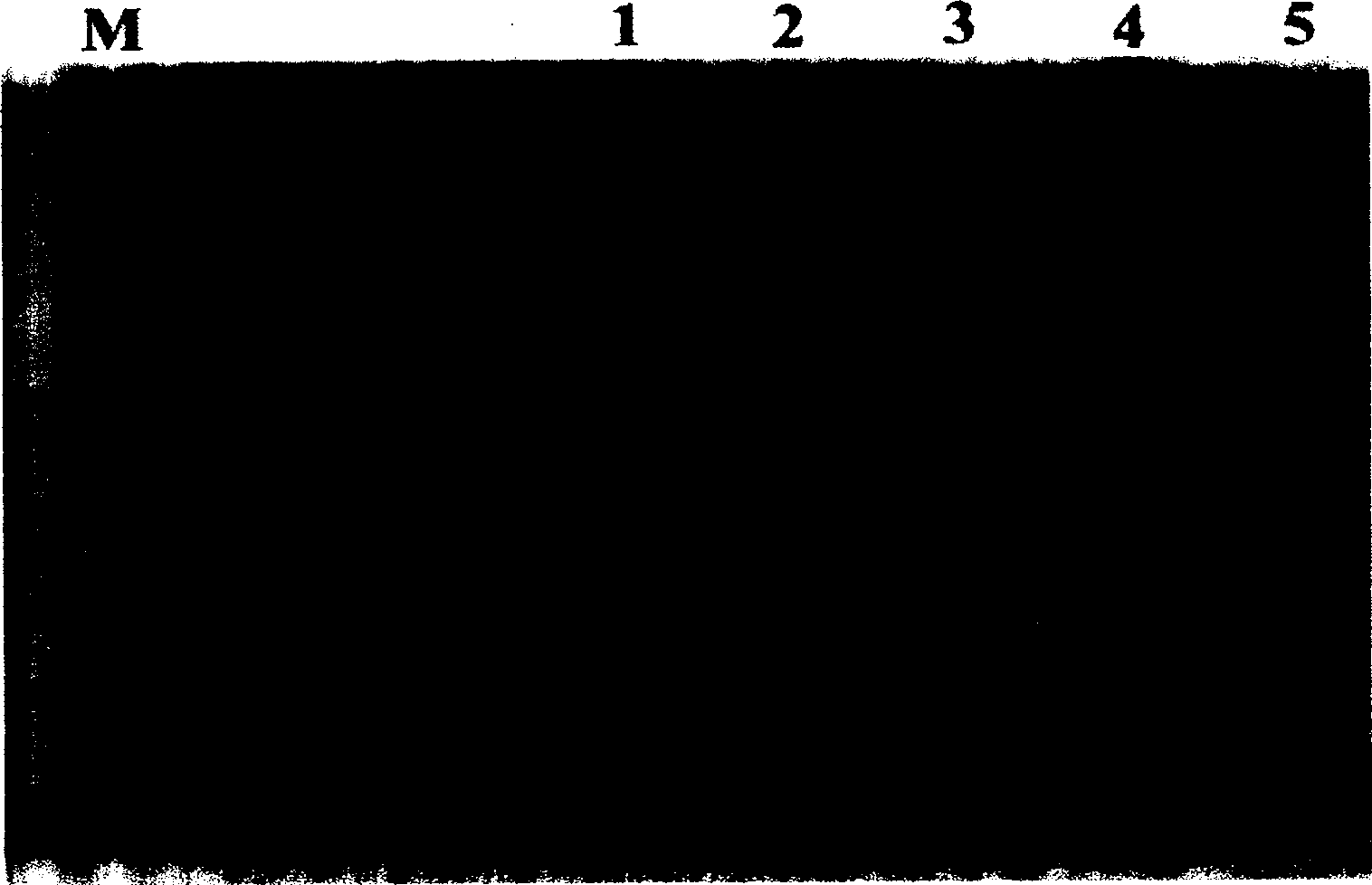 Cloning of Japanese blood fluke vaccine antigen gene and its expression and application