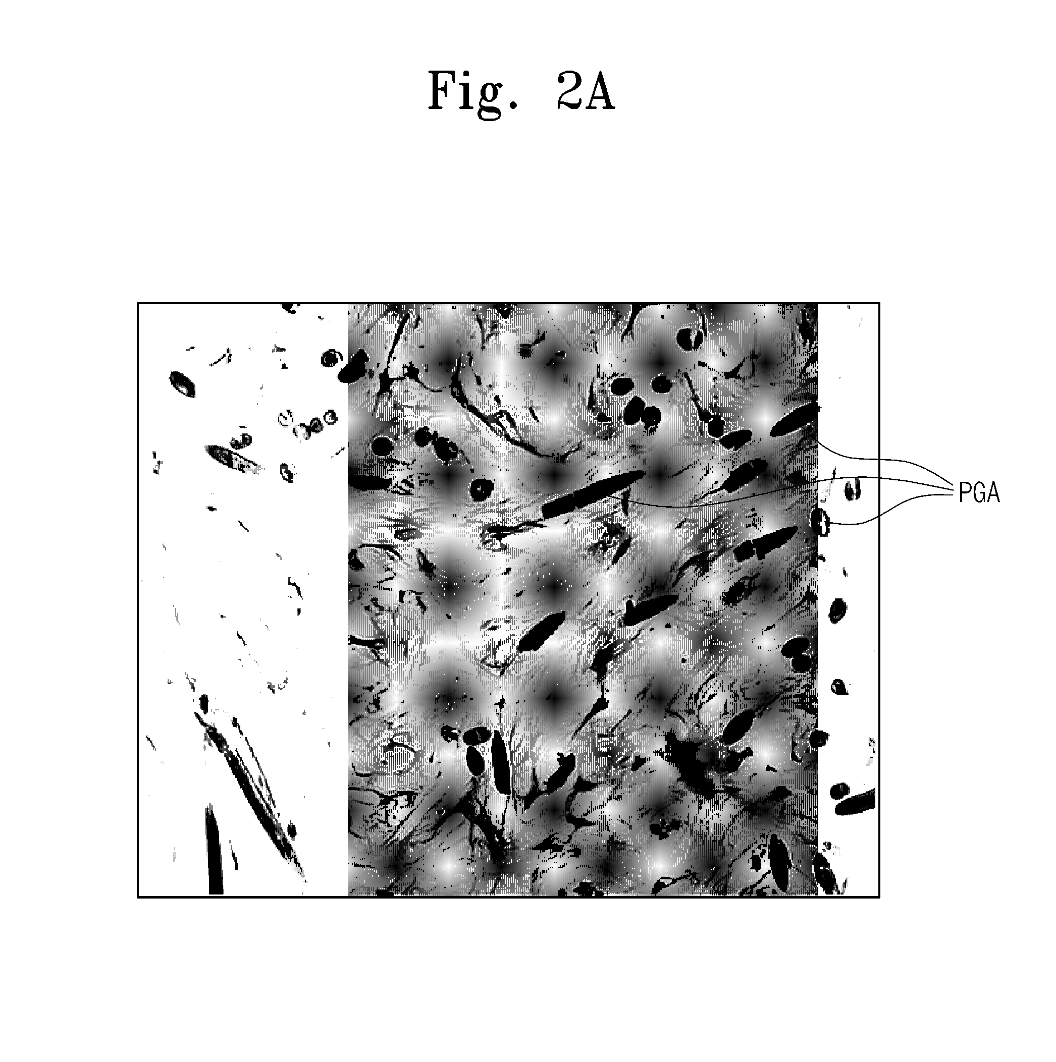 Method of chondrogenic differentiation from mesenchymal stem cell, and composition comprising chondrogenic cell differentiated using the method to treat disease caused by cartilage damage