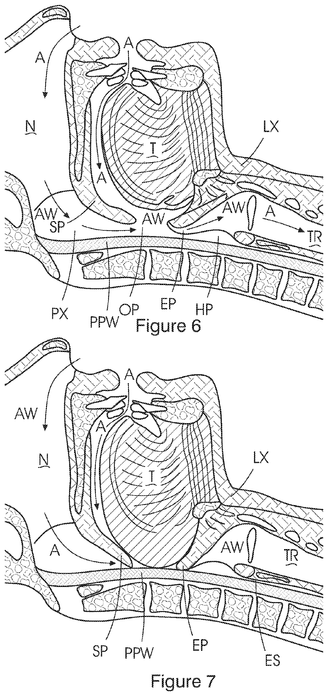 Implantable device