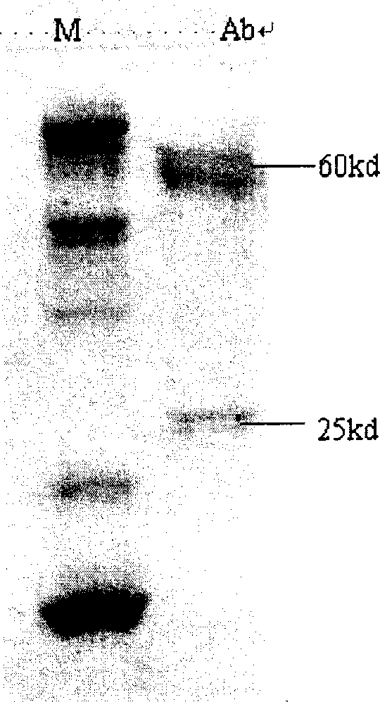 Monoclonal antibody for ketamine detection and immune detection board