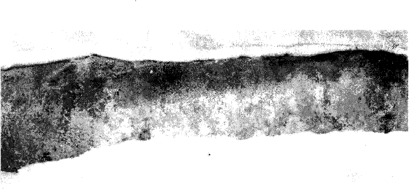 Sterilized heterogeneous medical biomembrane and preparing method thereof