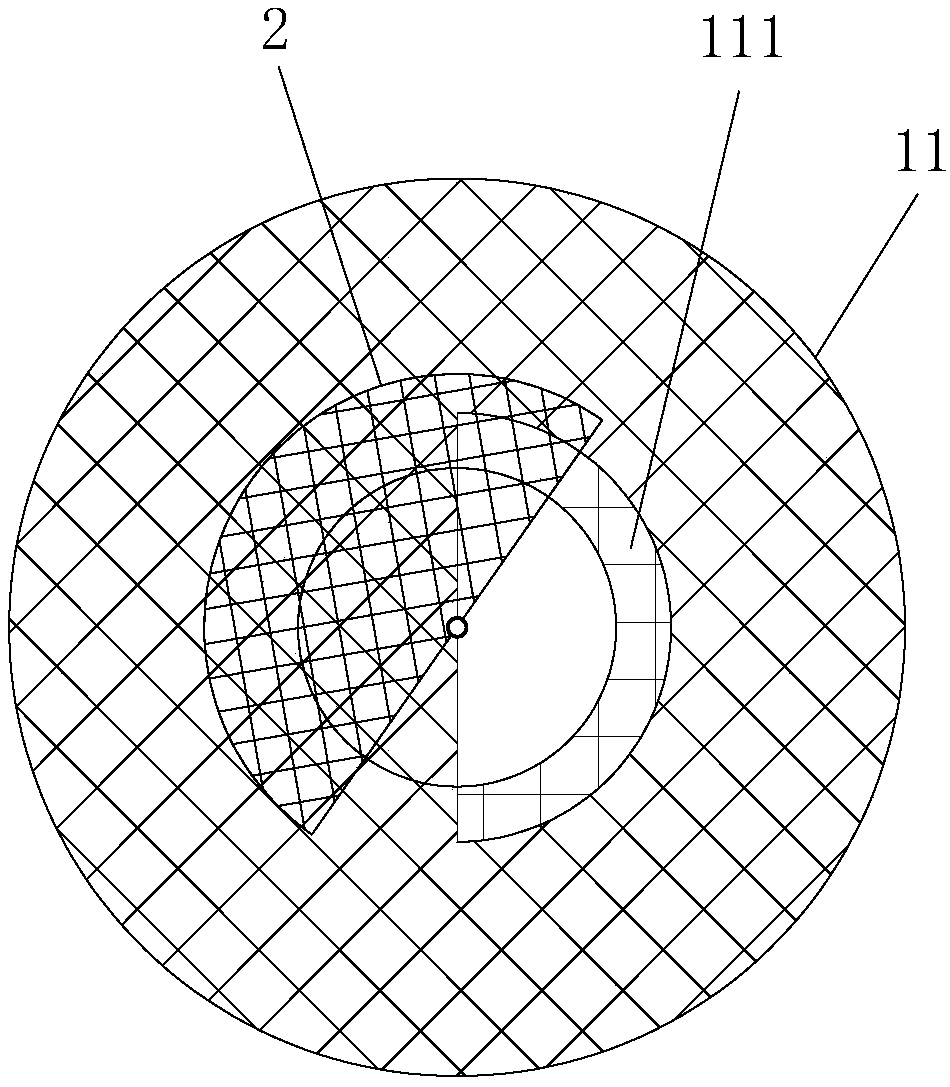 A blood flow restrictor for interventional surgery of congenital heart disease