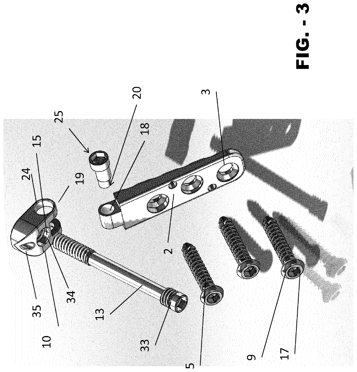 Internal fixation device for the pediatric correction of severe bone malformations