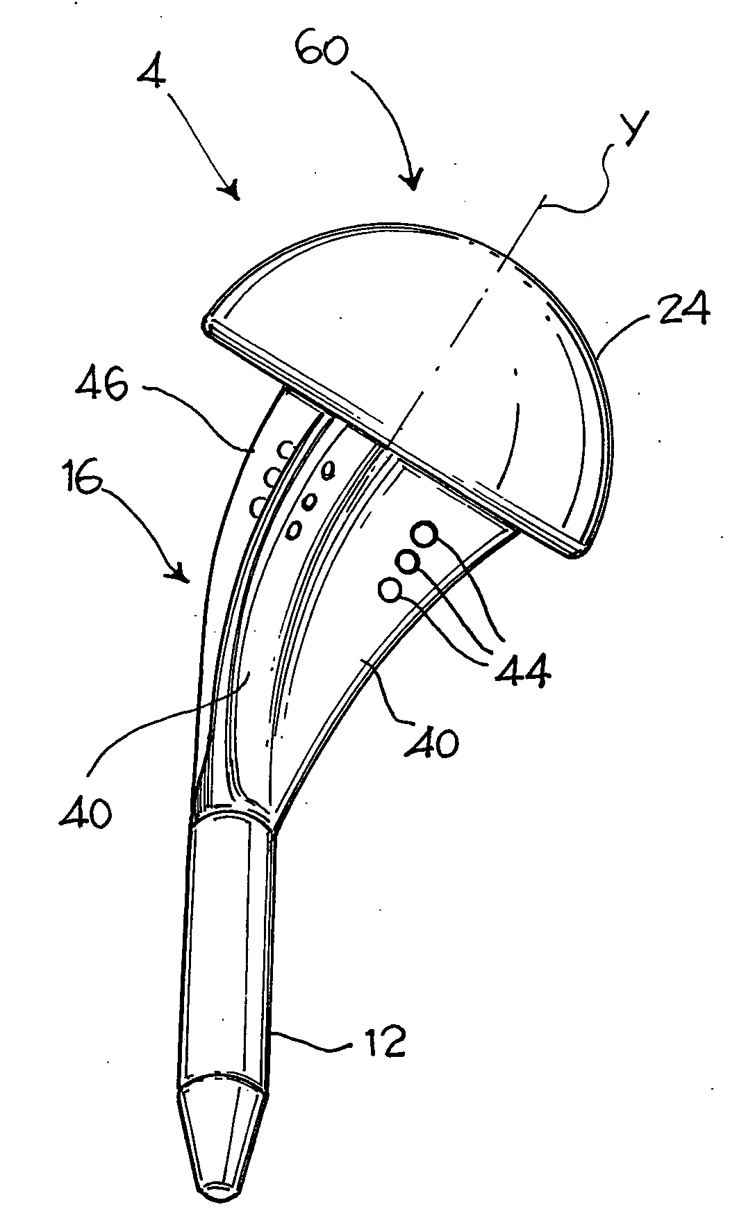 Shoulder Prosthesis