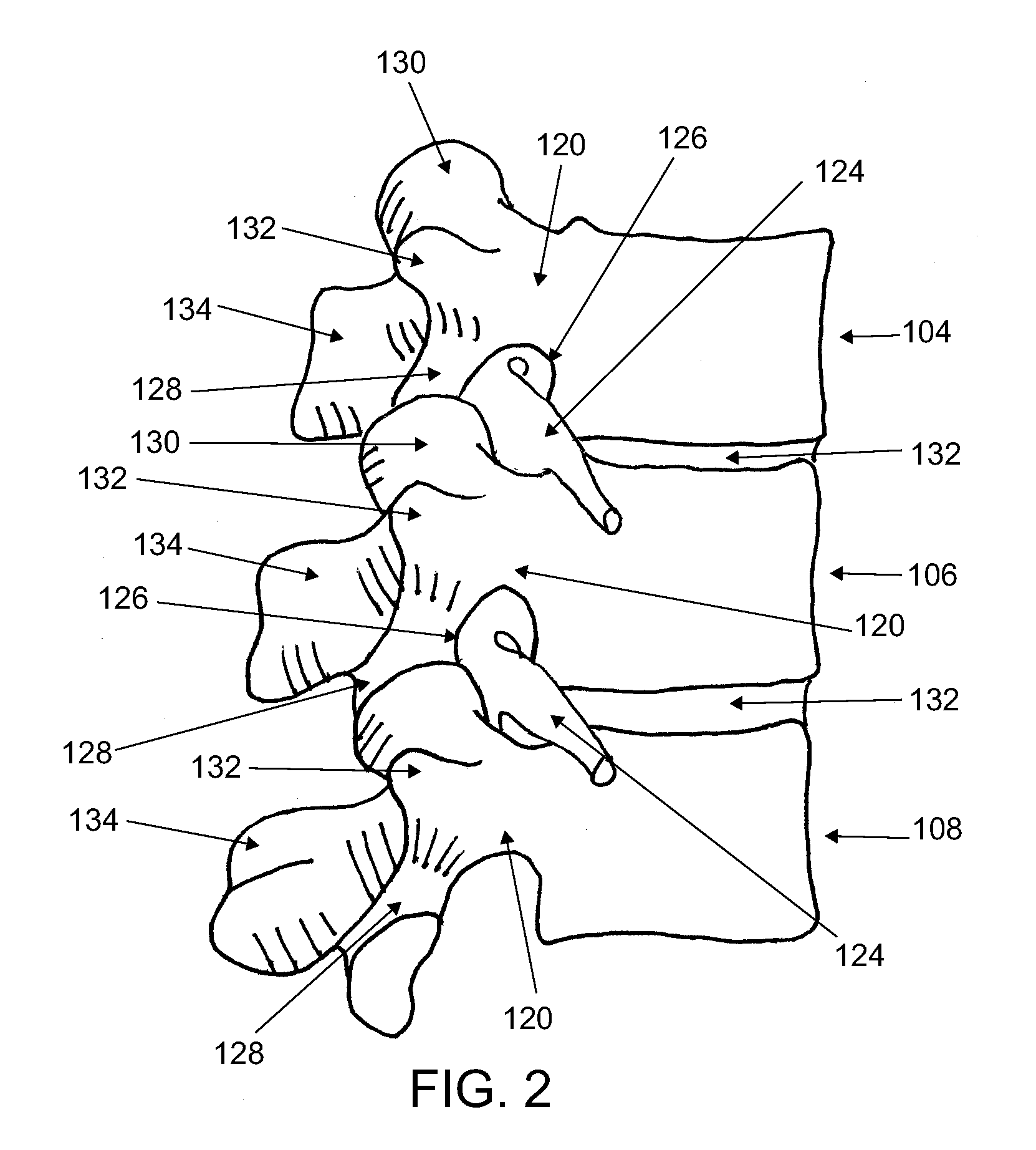 Systems and methods for cable-based tissue removal