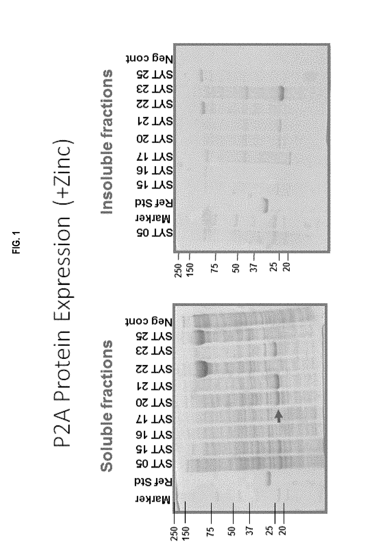 Carbapenemases for use with antibiotics for the protection of the intestinal microbiome