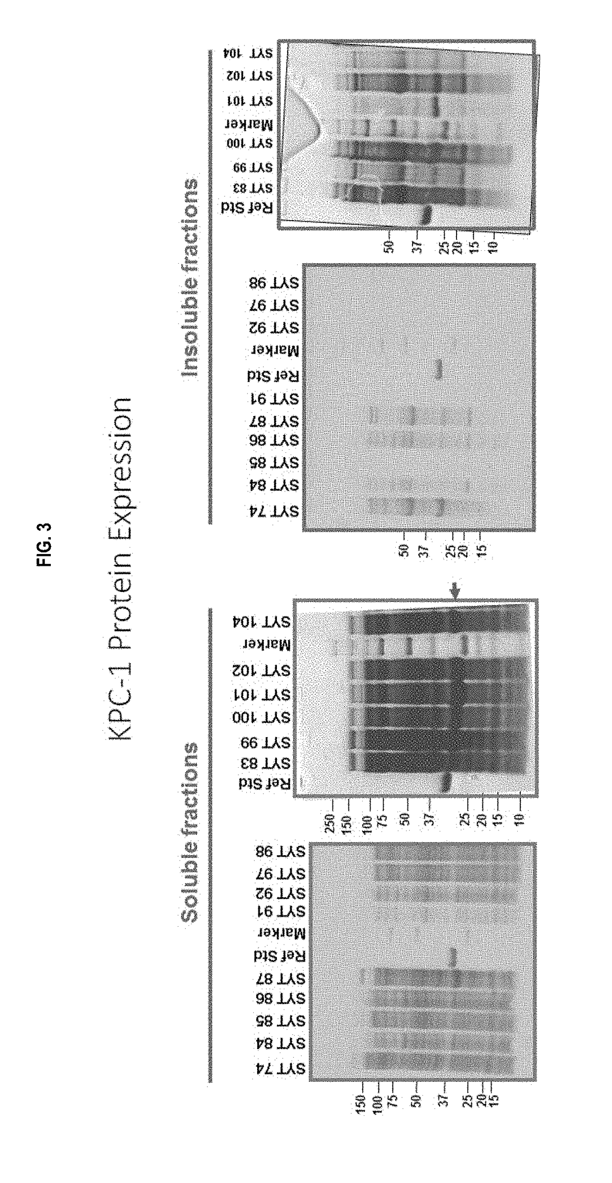 Carbapenemases for use with antibiotics for the protection of the intestinal microbiome