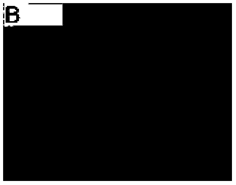 Method of improving killing effect of CIK cells on cancer cells