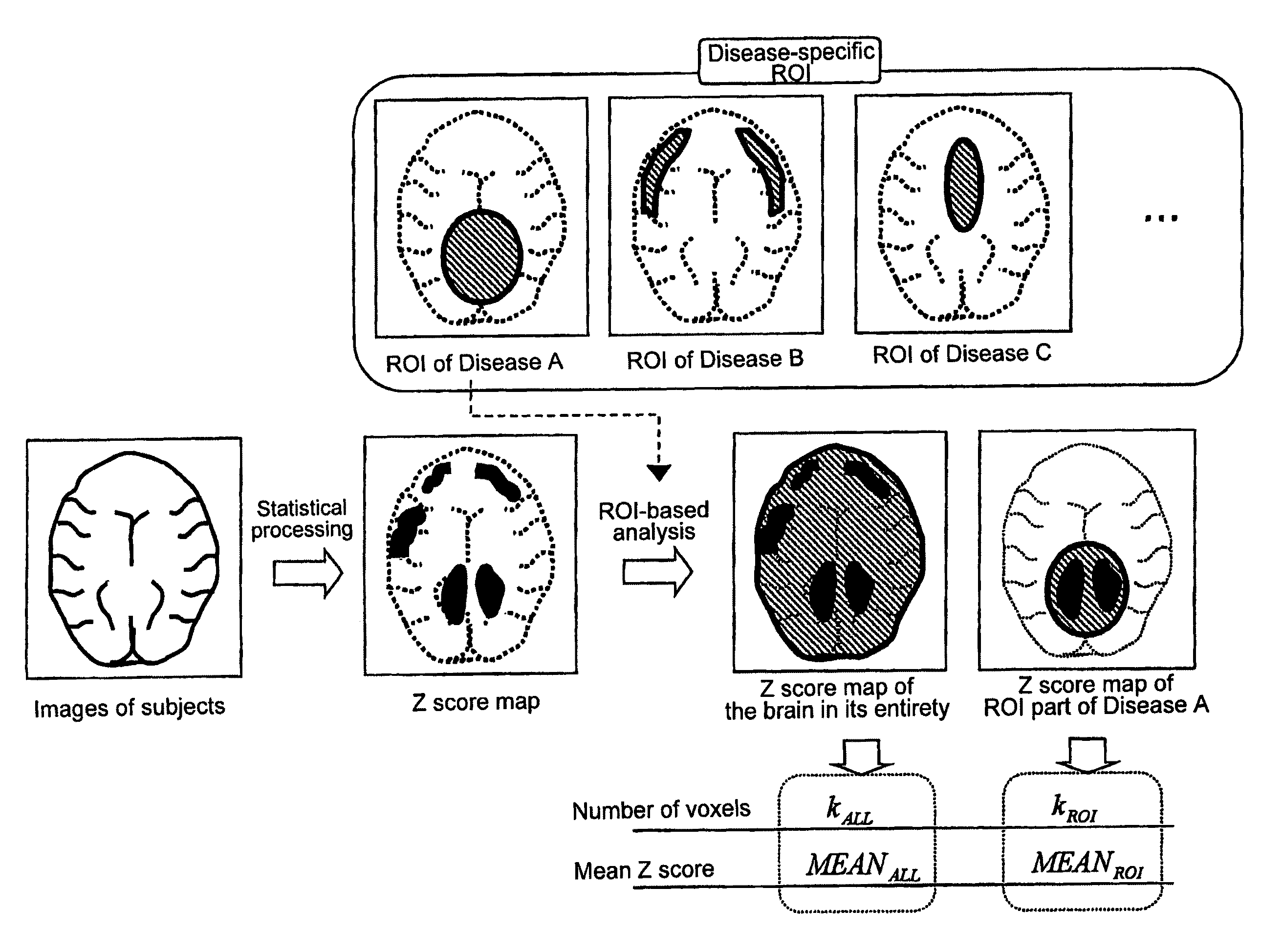 Method for assisting in diagnosis of cerebral diseases and apparatus thereof