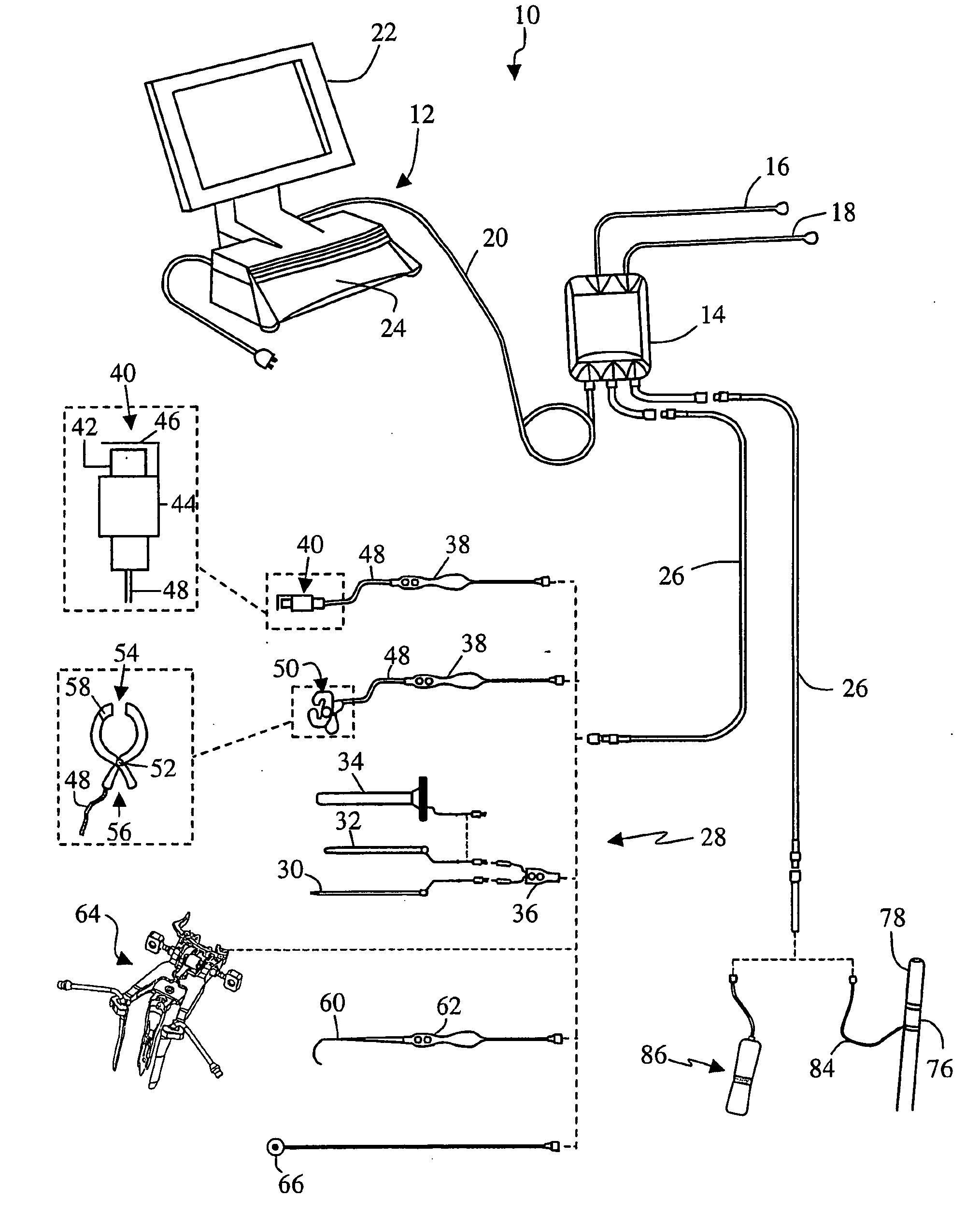 System and methods for monitoring during anterior surgery