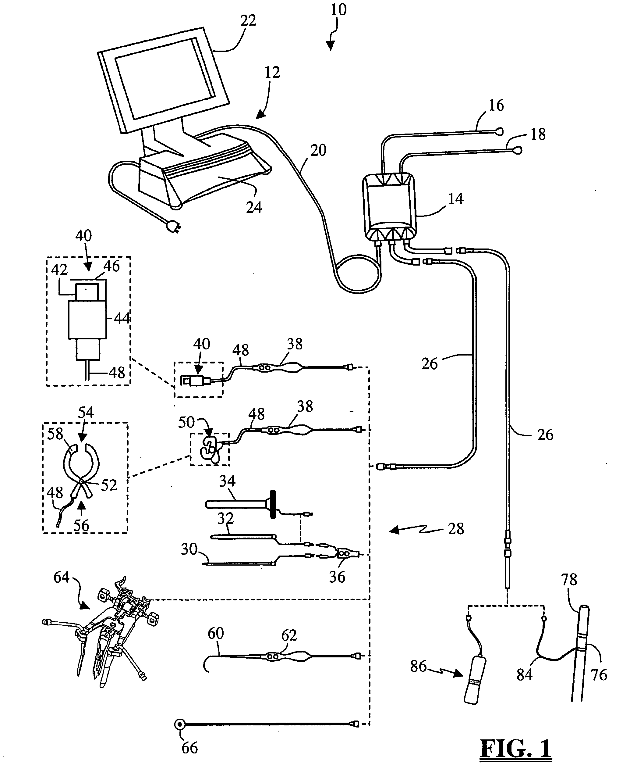 System and methods for monitoring during anterior surgery