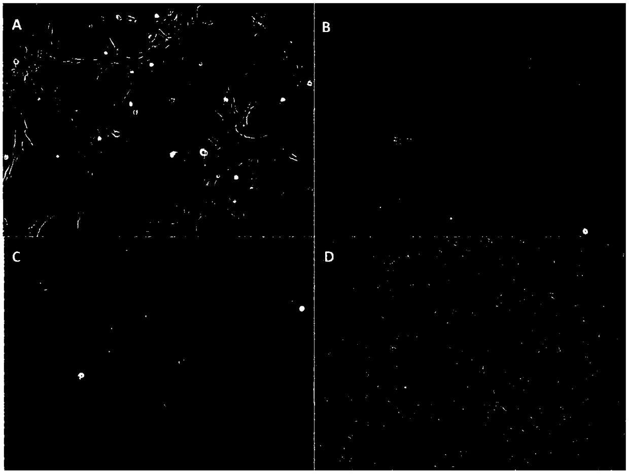 Tilapia brain cell line and application thereof