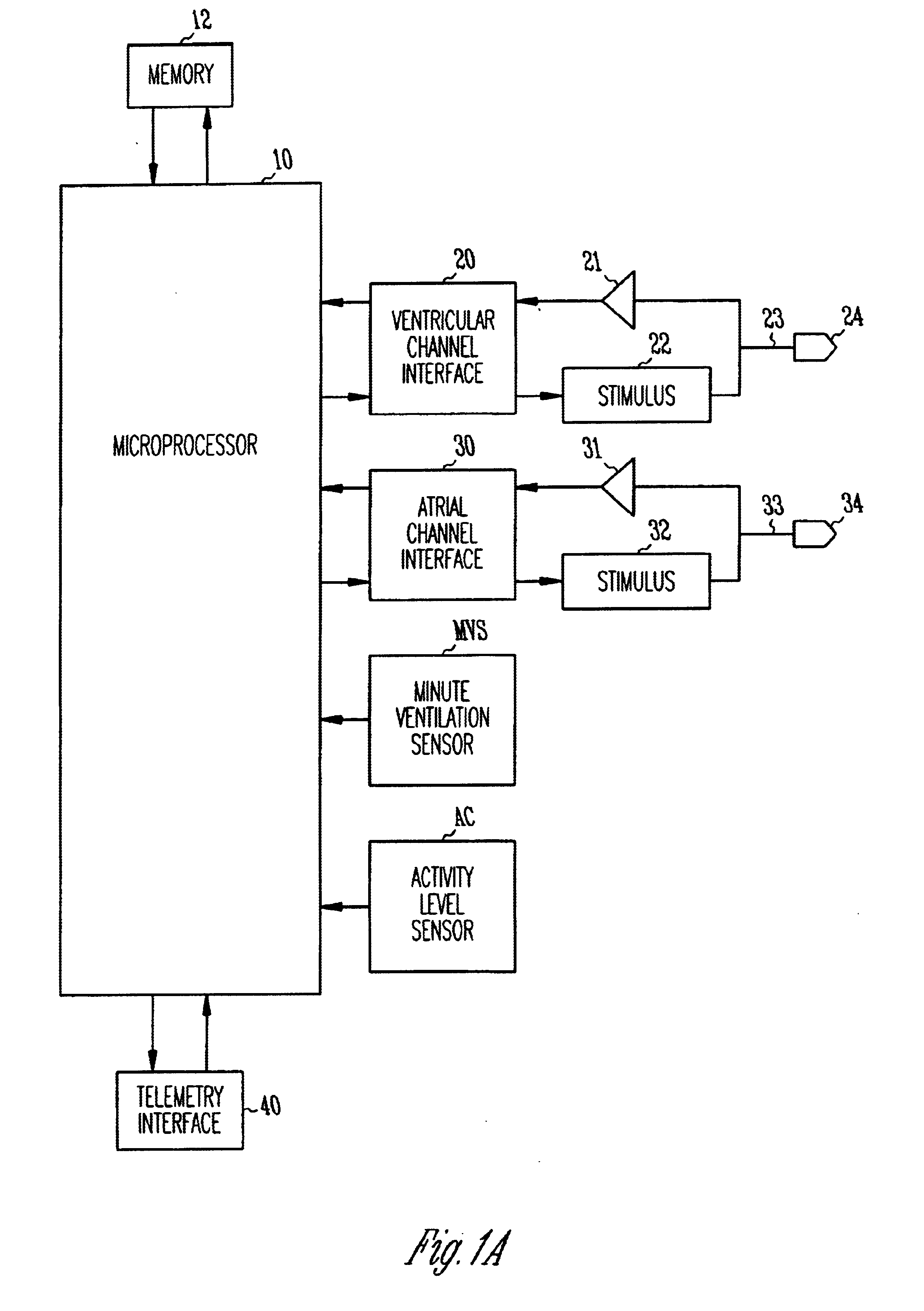 Rate-adaptive therapy with automatic limiting of maximum pacing rate