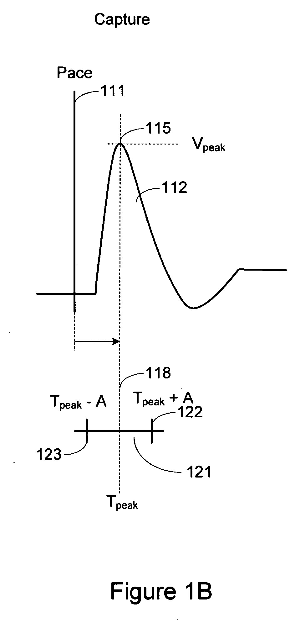 Cardiac pacing response classification using an adaptable classification interval