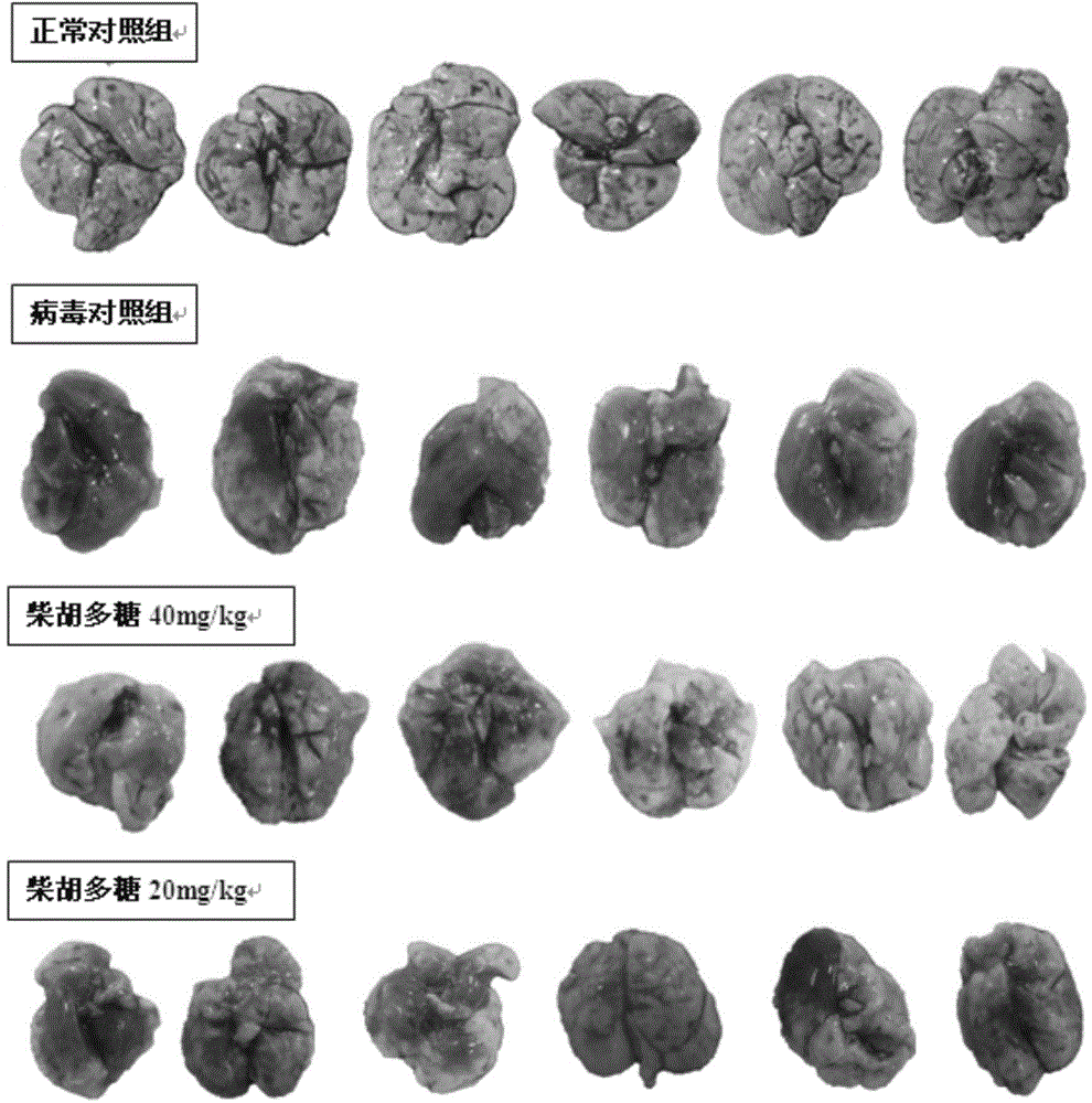 Application of radix bupleuri polysaccharide in preparing medicine for preventing and treating vaccinum influenzae vivum and virus pneumonia