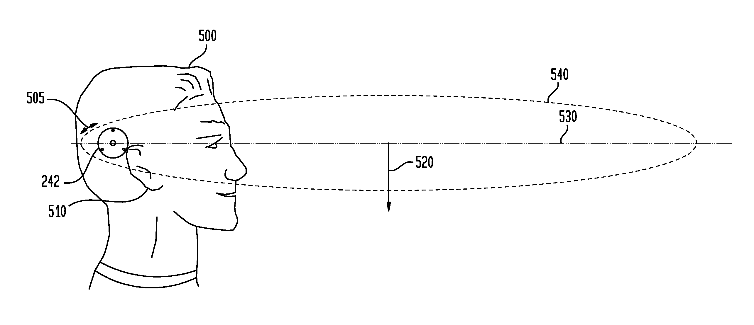 Sound capture focus adjustment for hearing prosthesis