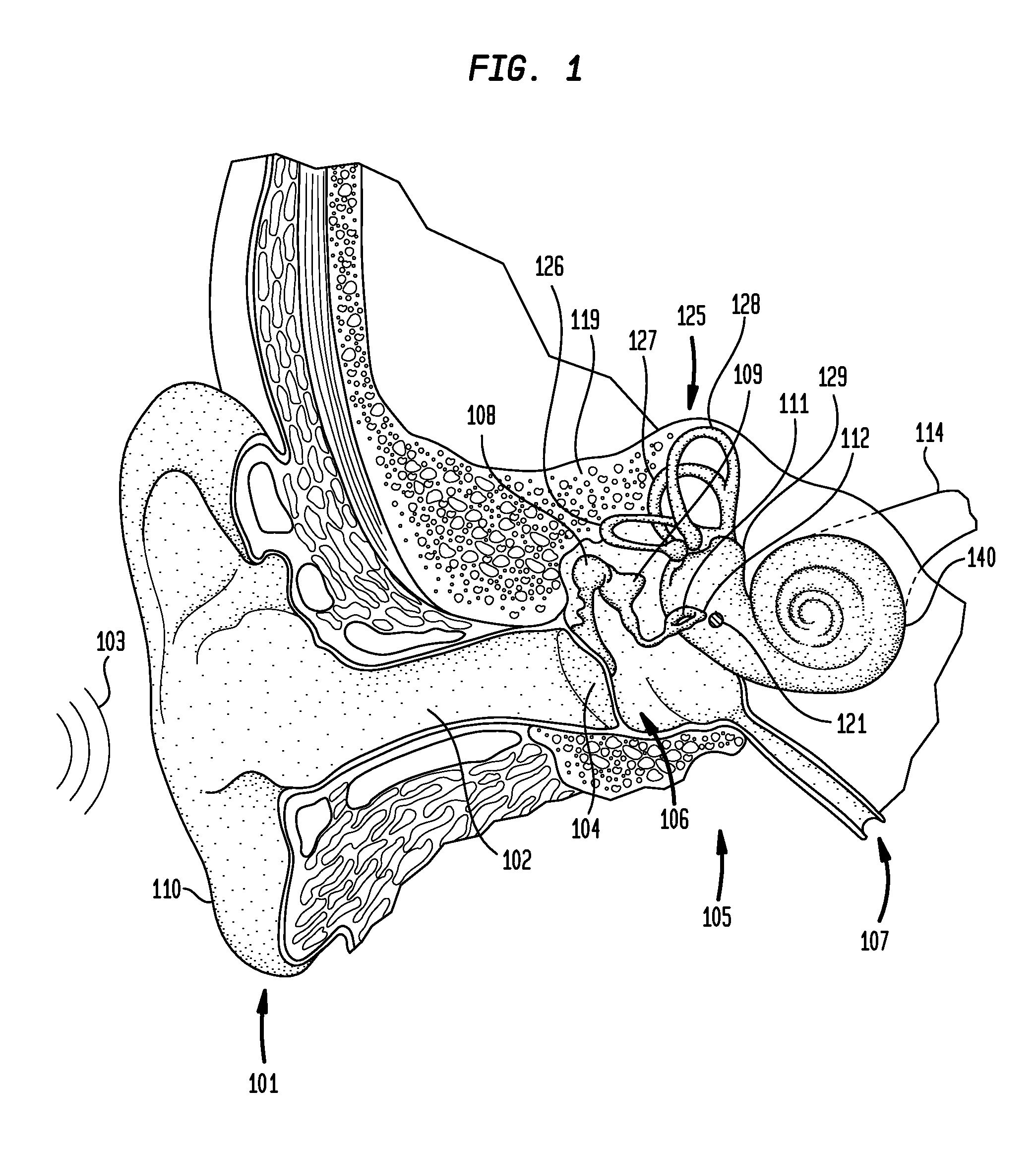 Sound capture focus adjustment for hearing prosthesis