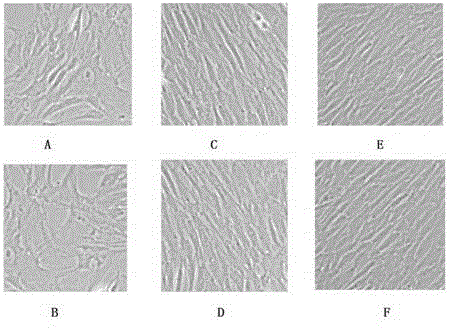 Separation and culture method of bovine umbilical cord mesenchymal stem cells