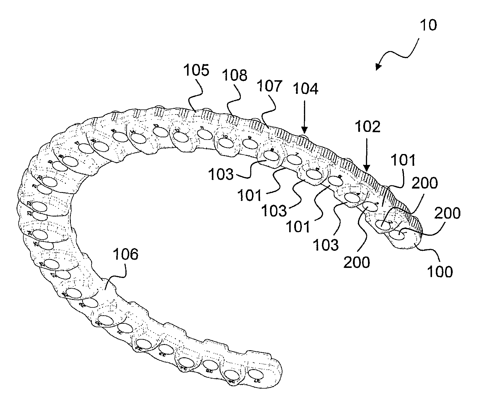 External fixation system