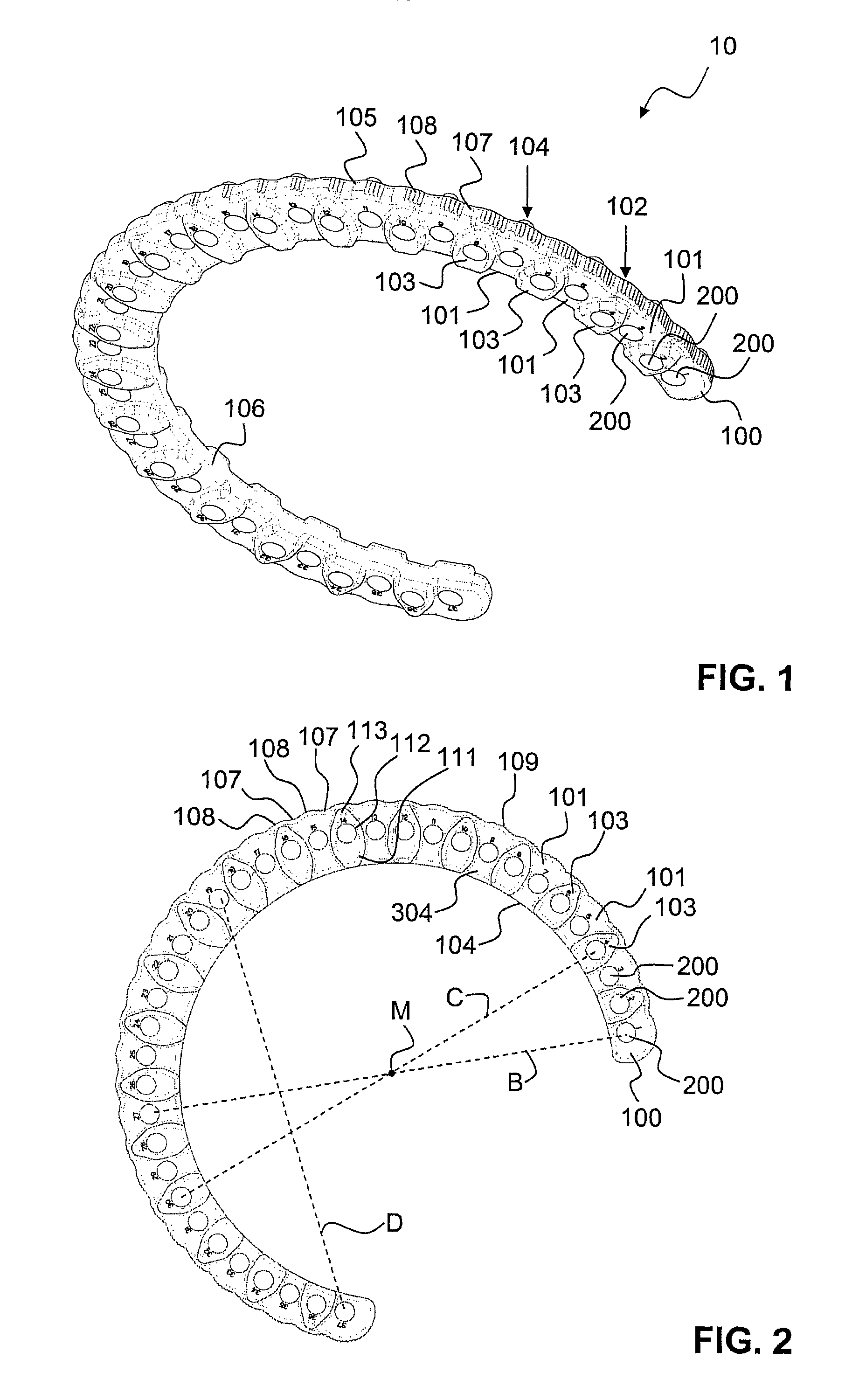 External fixation system