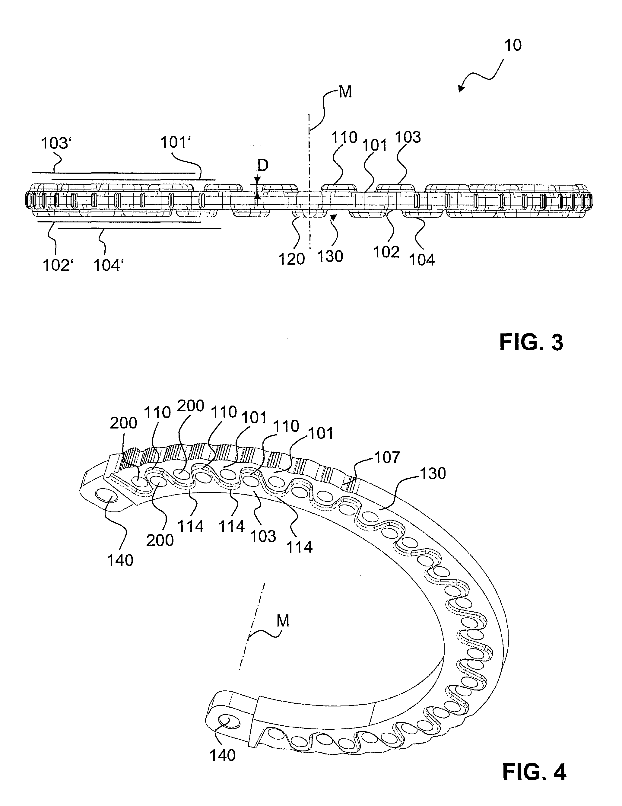 External fixation system