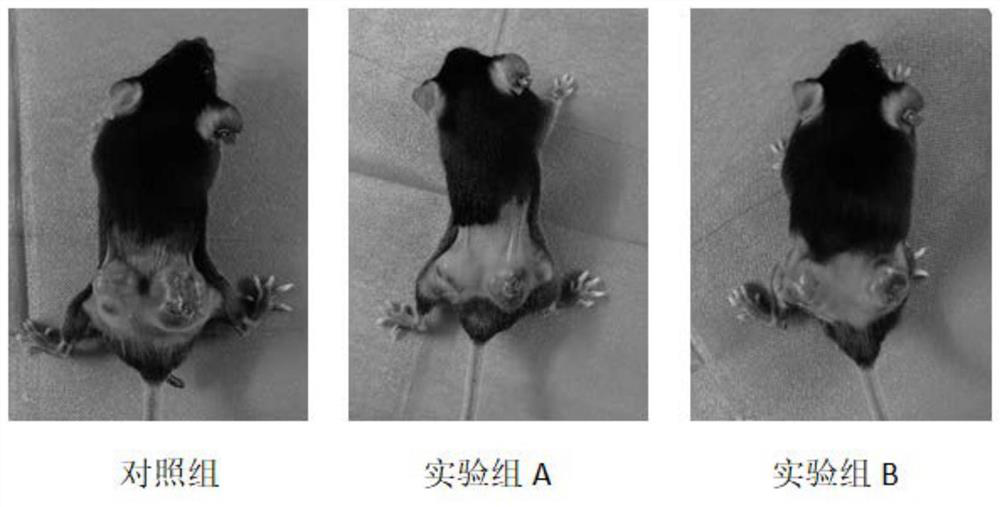 DNA drug for treating tumors by targeted immune system and application thereof