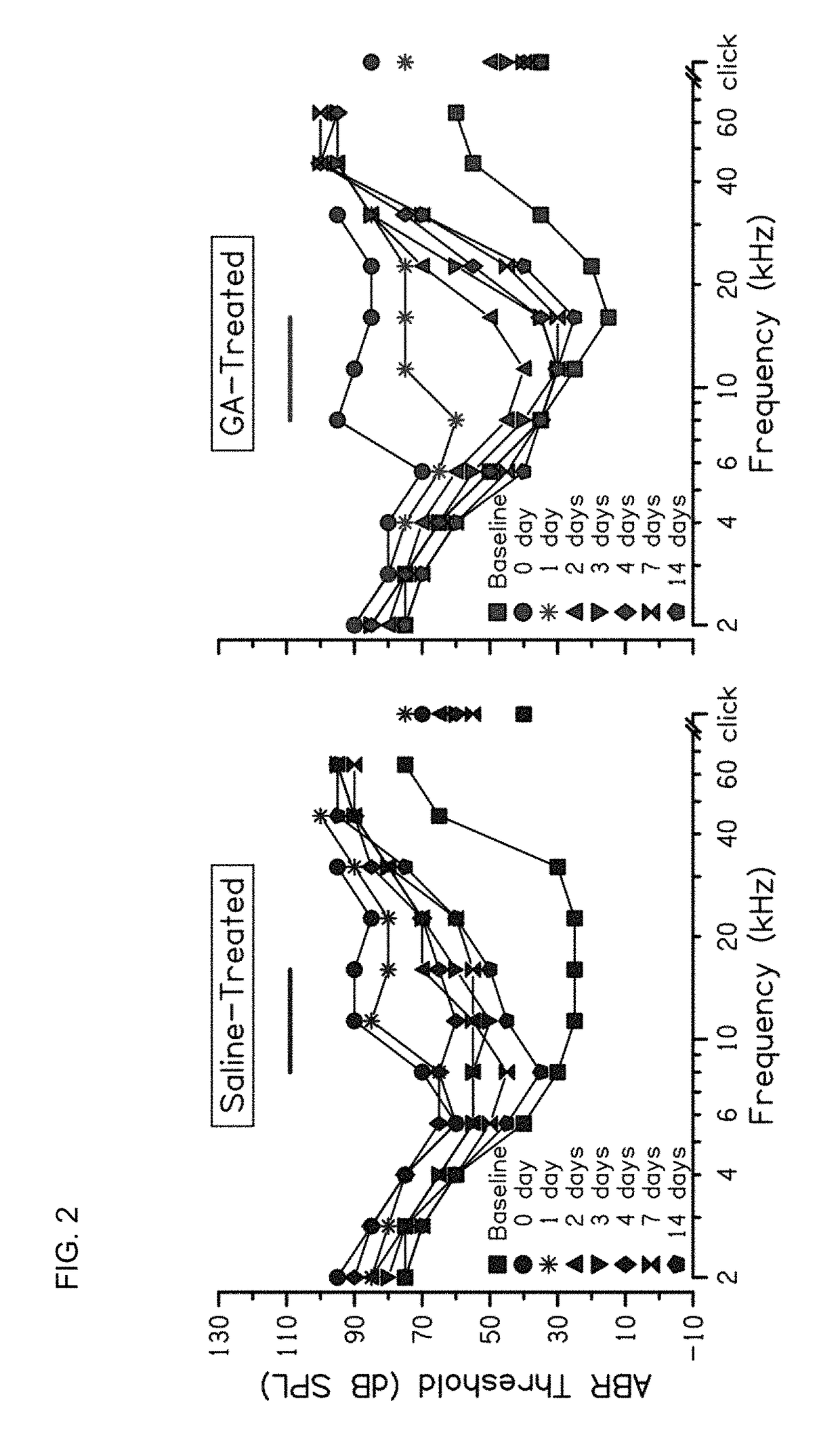 Treatment of noise induced hearing loss