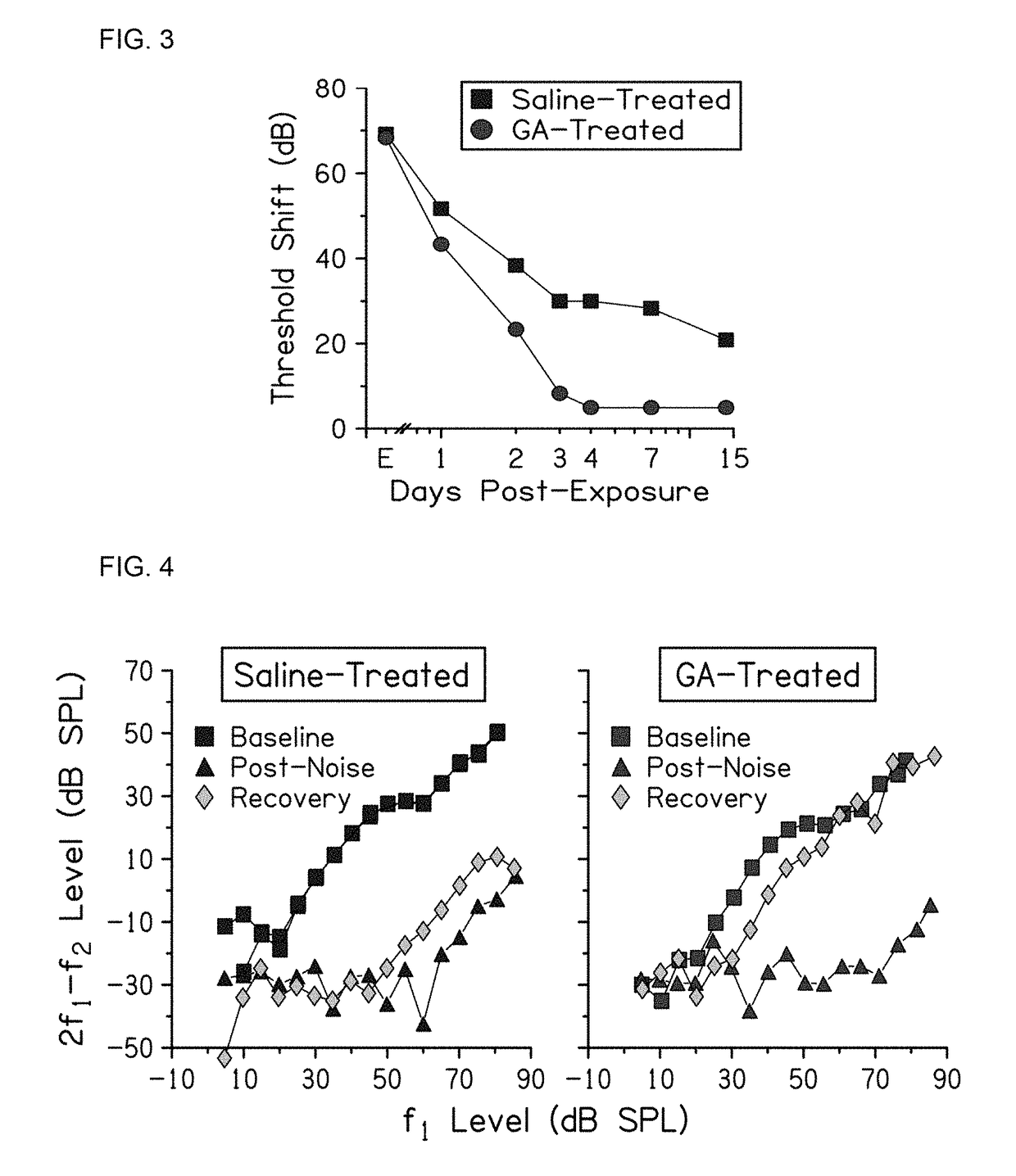 Treatment of noise induced hearing loss