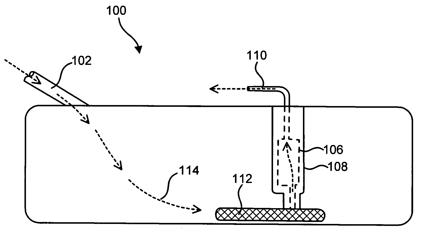 Gradient density depth filtration system