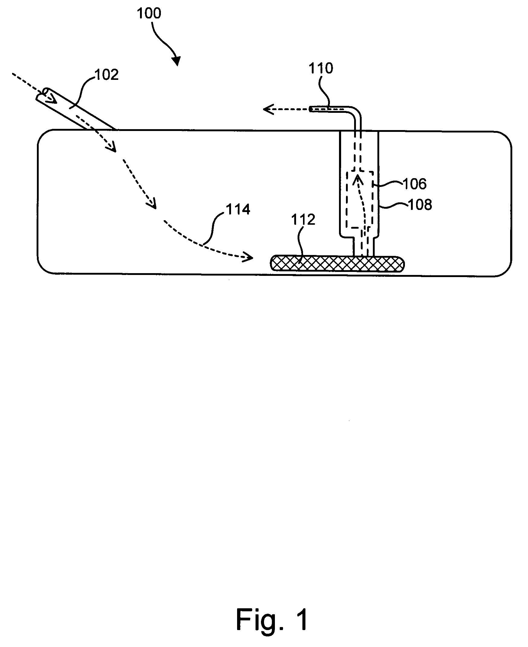 Gradient density depth filtration system