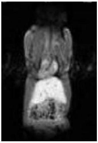 A New Contrast Agent for CT