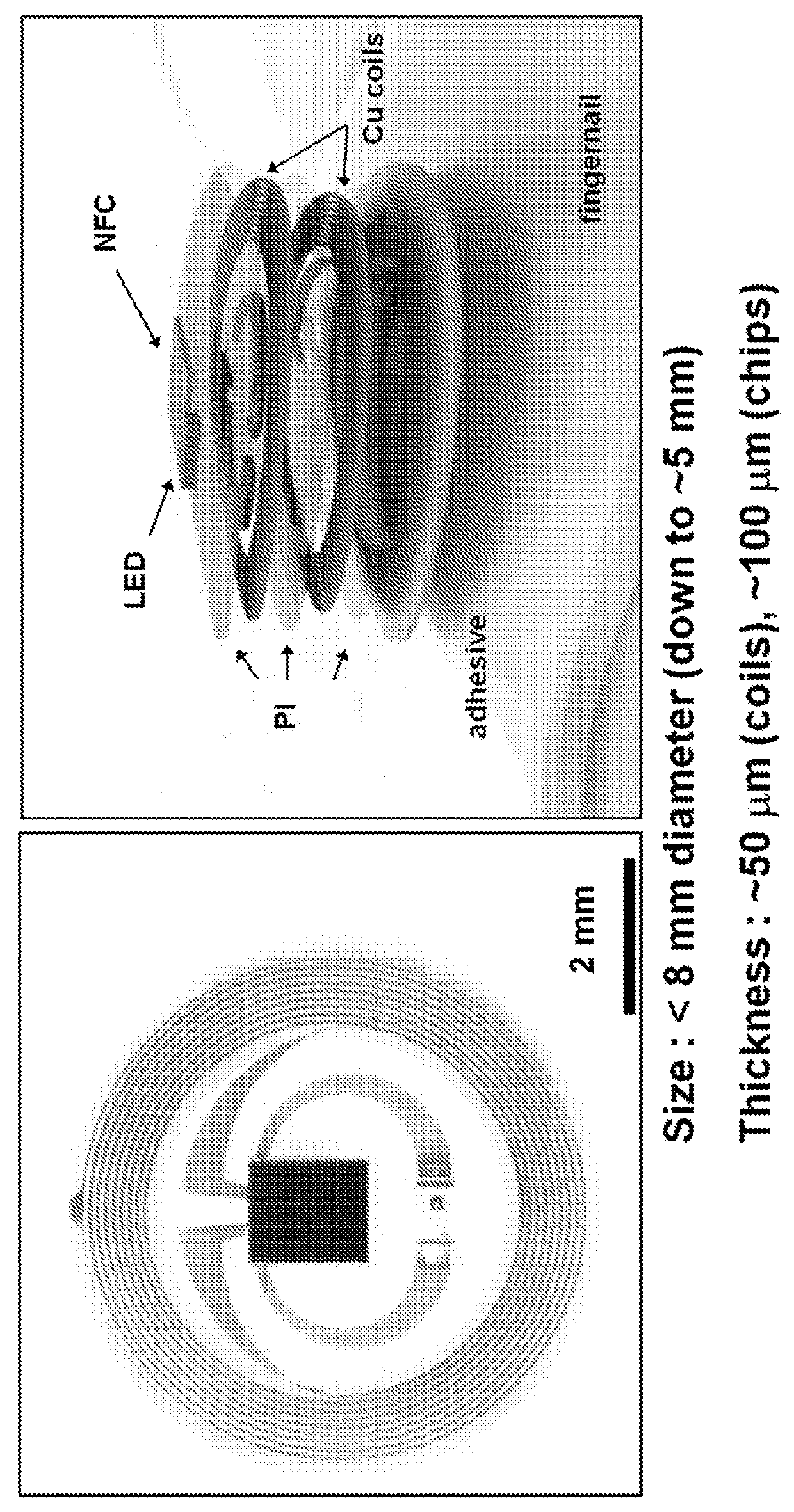 Miniaturized electronic systems with wireless power and near-field communication capabilities