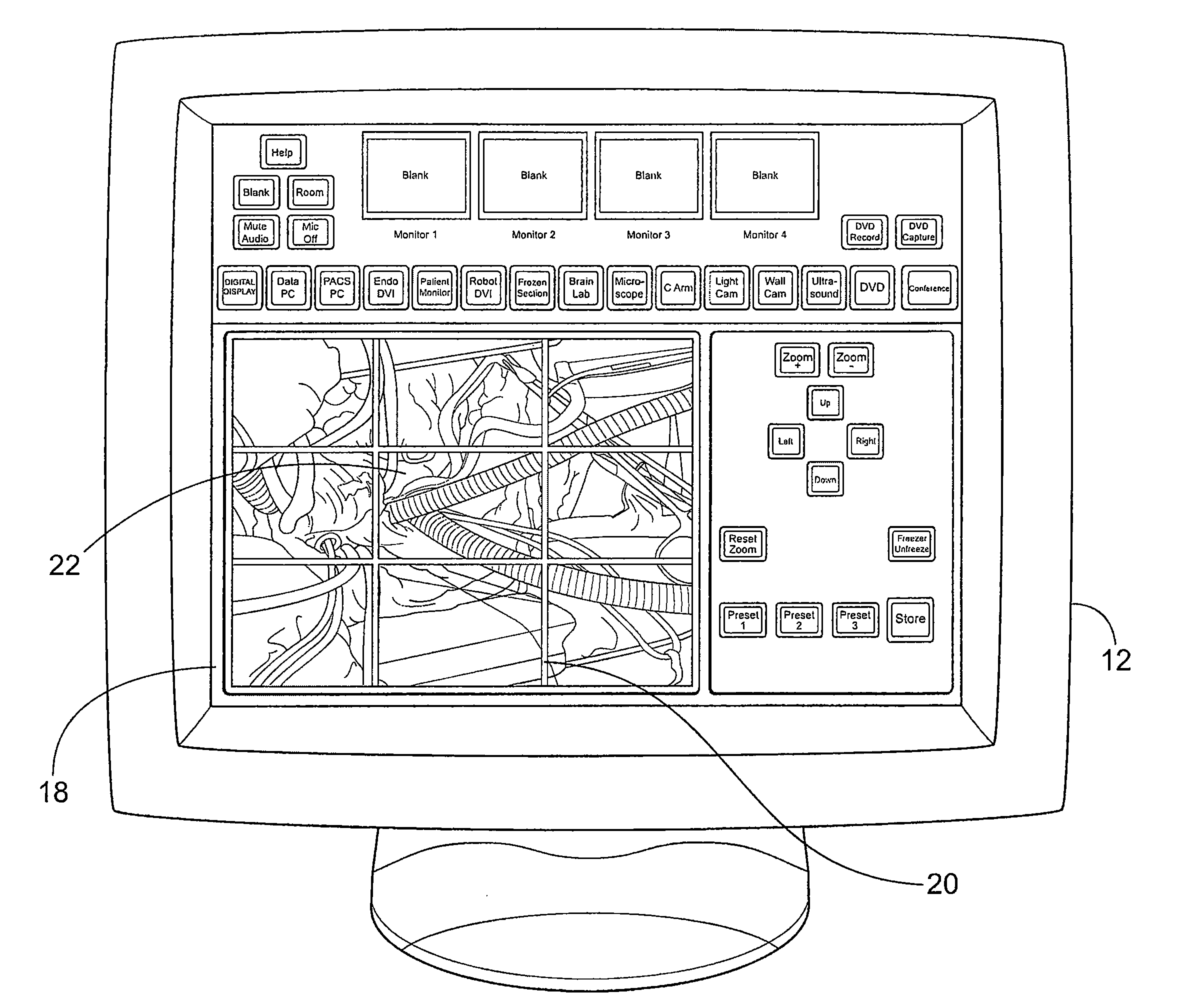 Target Acquisition System