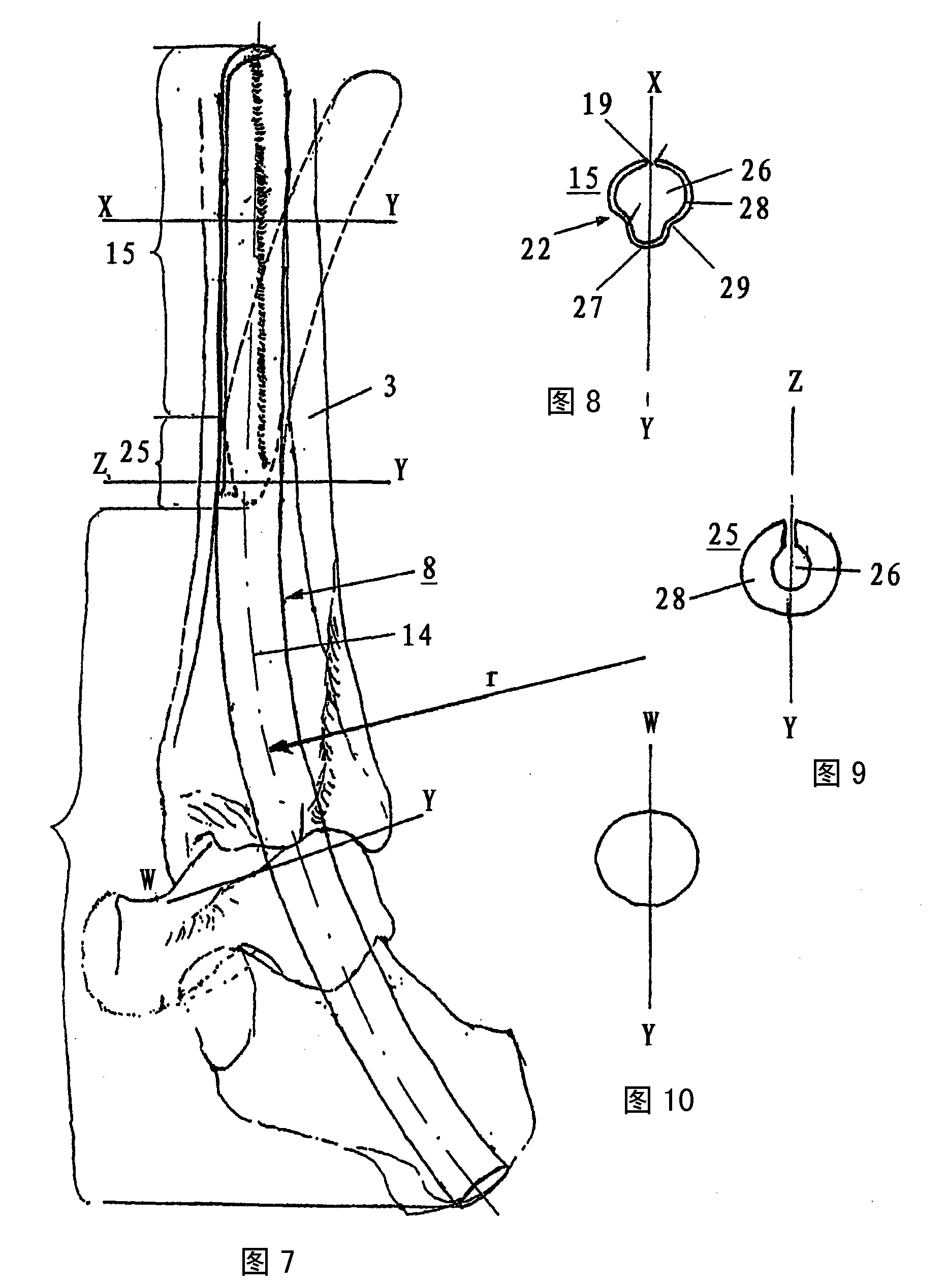 Bone nail for the heel and osteosynthesis suite