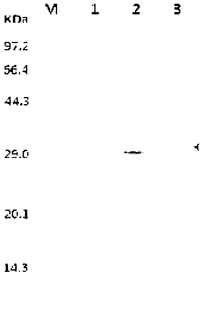 Tertiary alcohol ester hydrolase, encoding gene, carrier, engineering bacteria and application thereof