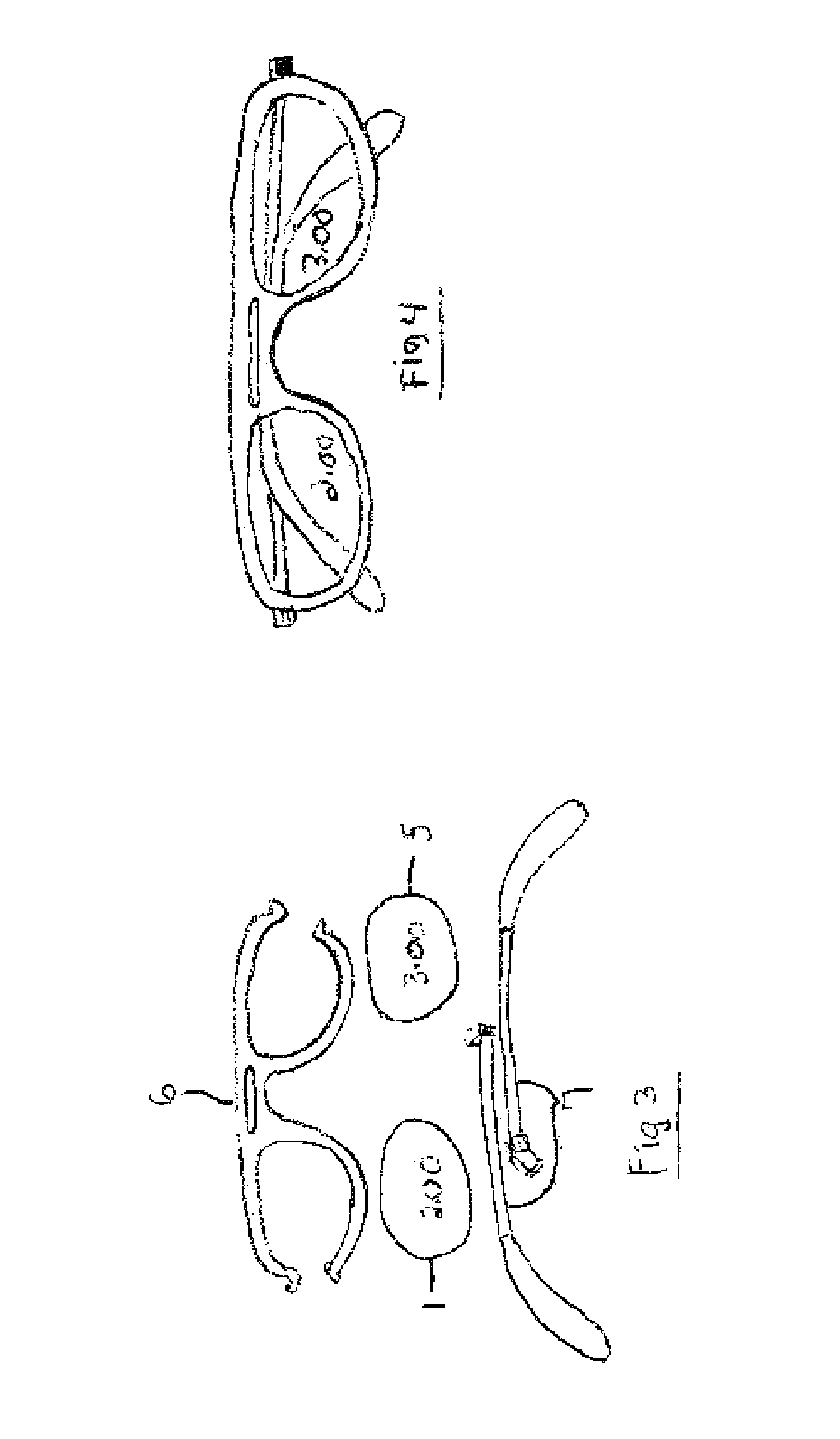 Vision correction method