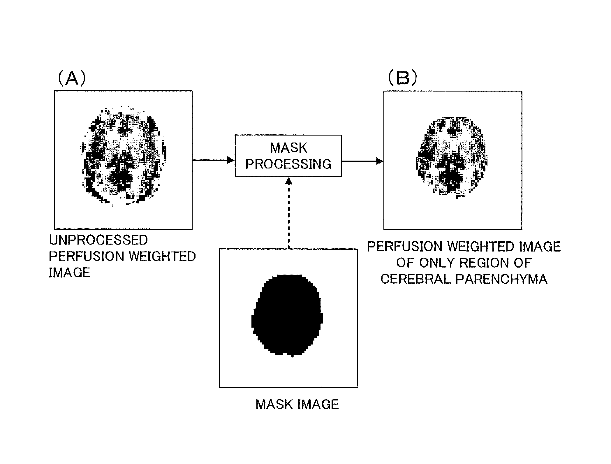 Medical image display processing method, device, and program