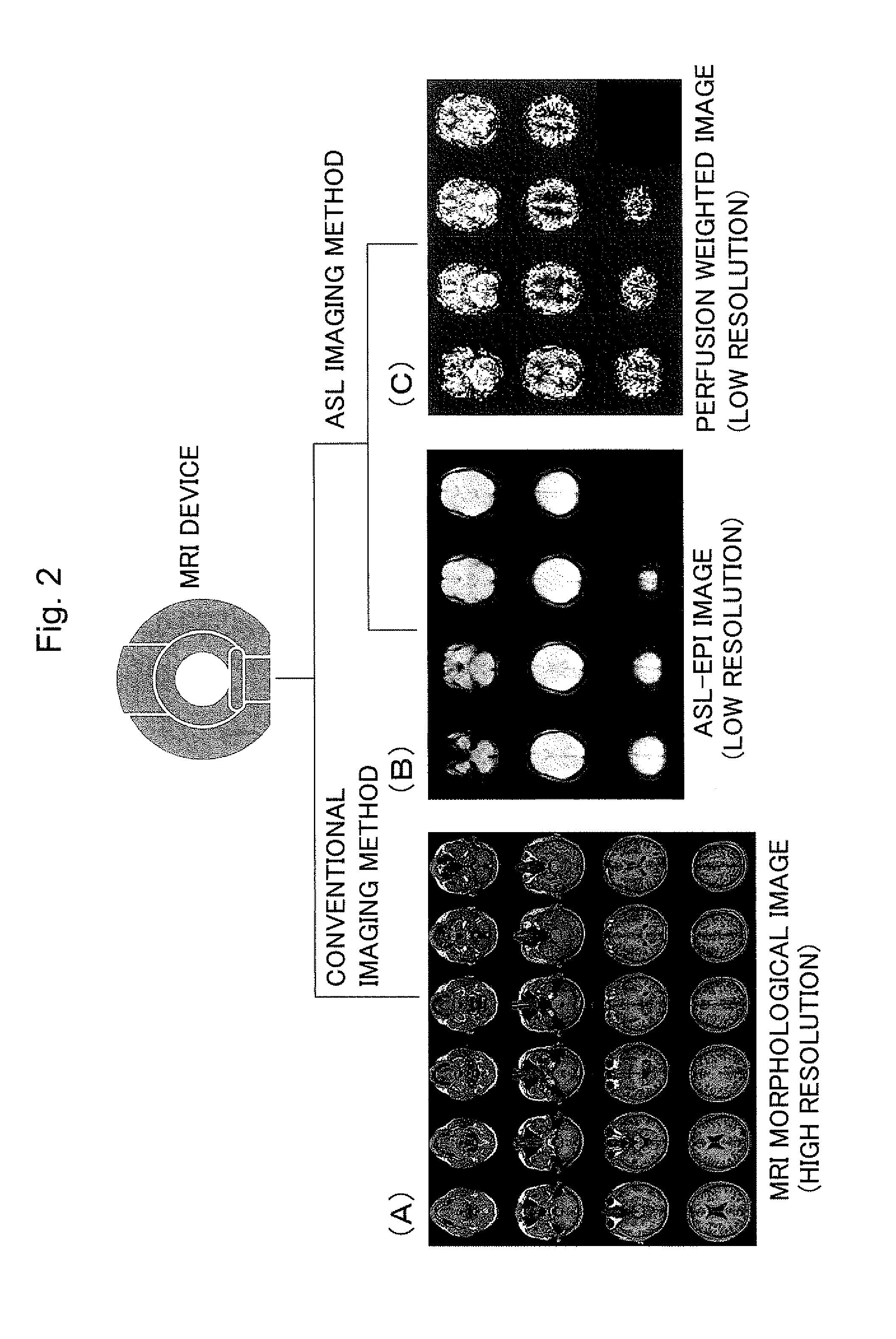 Medical image display processing method, device, and program