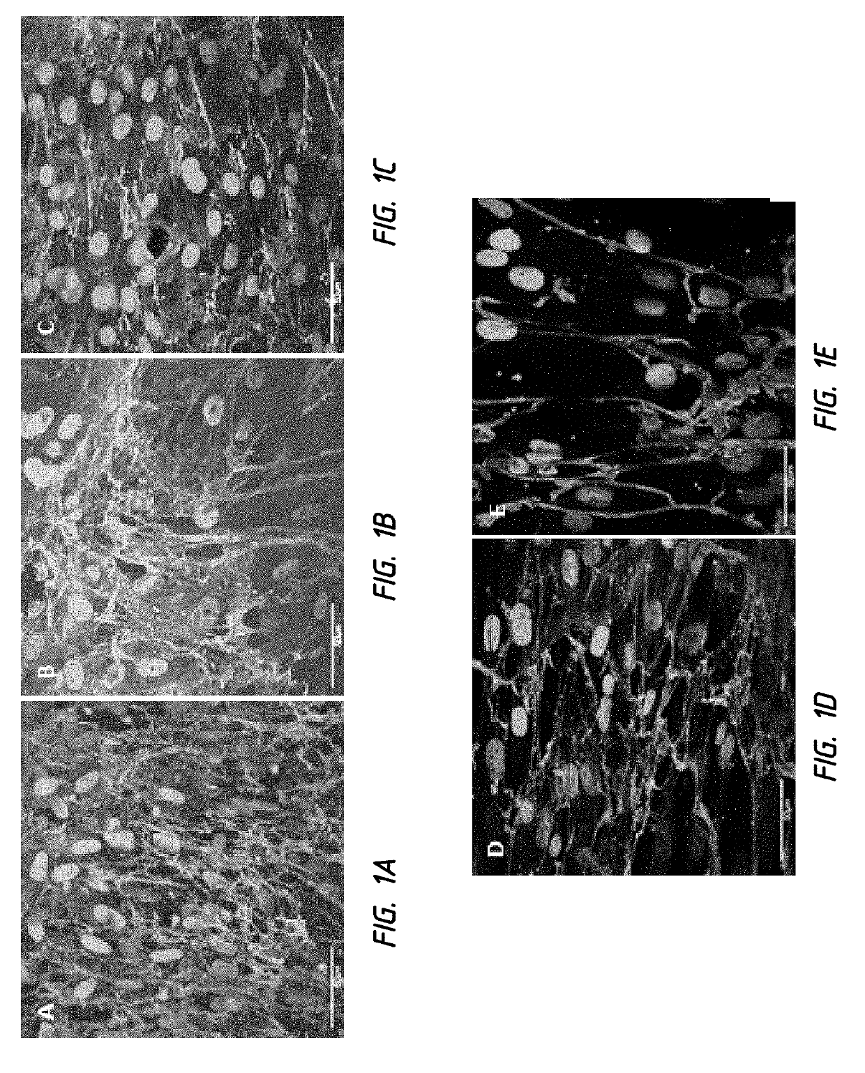 In vivo synthesis of elastic fiber