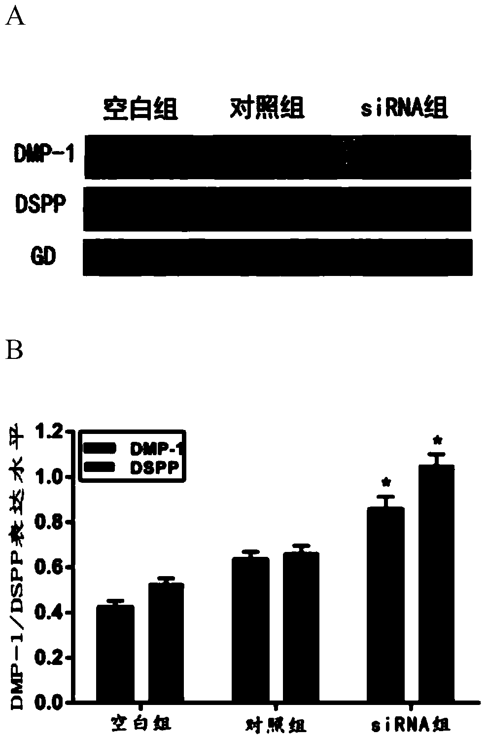 Small interfering RNA targeting human irak1 gene and its application