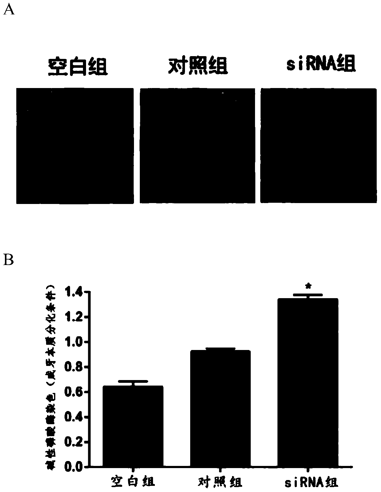 Small interfering RNA targeting human irak1 gene and its application