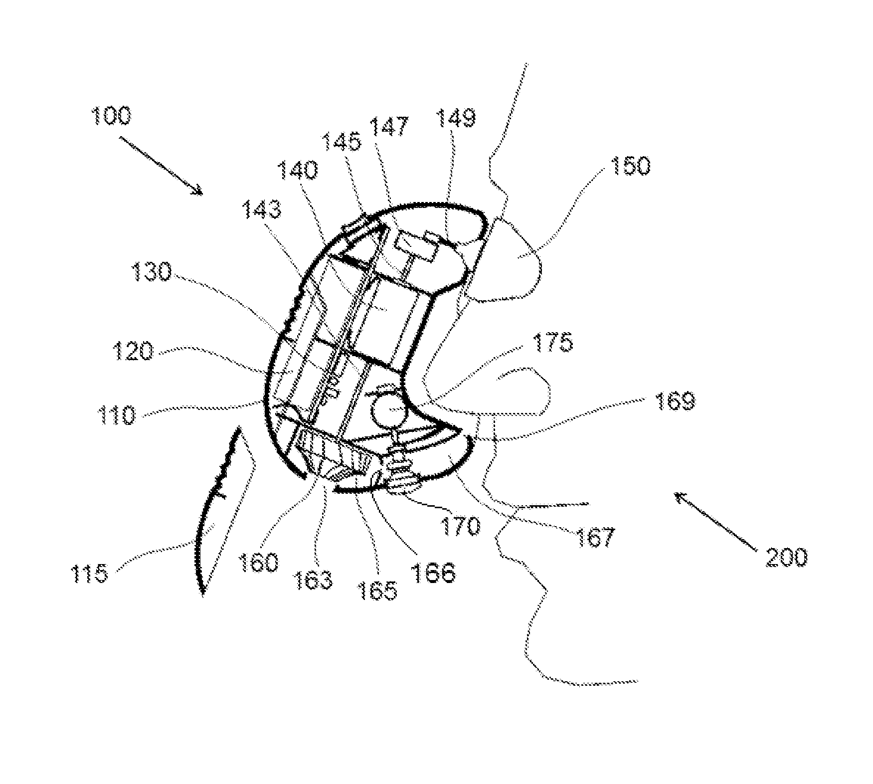 Vibrating device for treating nasal congestion and sinusitis symptoms and method thereof